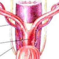 Ovariohisterectomia